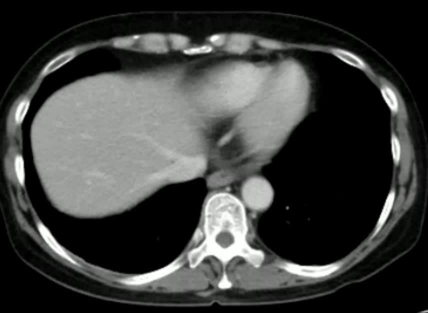 図1　CASEの腹部造影CT画像の動画